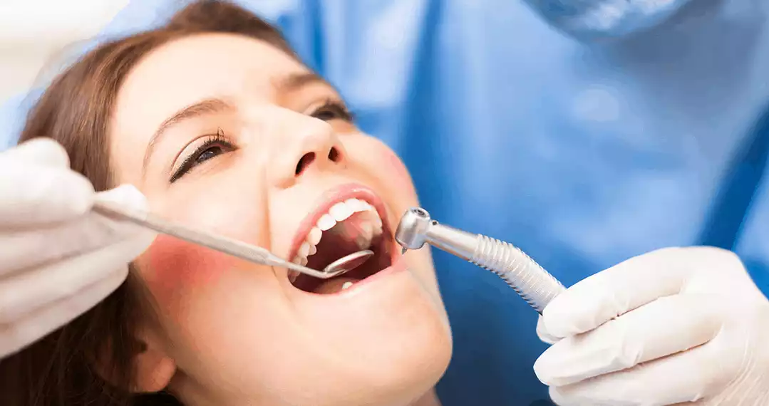 What You Need to Know About Root Canal Treatment: A Comprehensive Guide