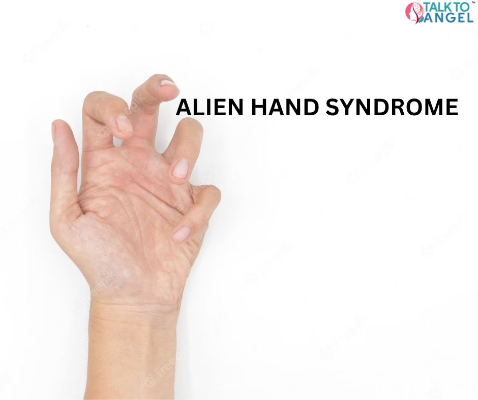 What Are the Symptoms of Alien Hand Syndrome?