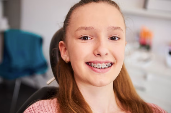 Invisalign Is Recommended For Children Too