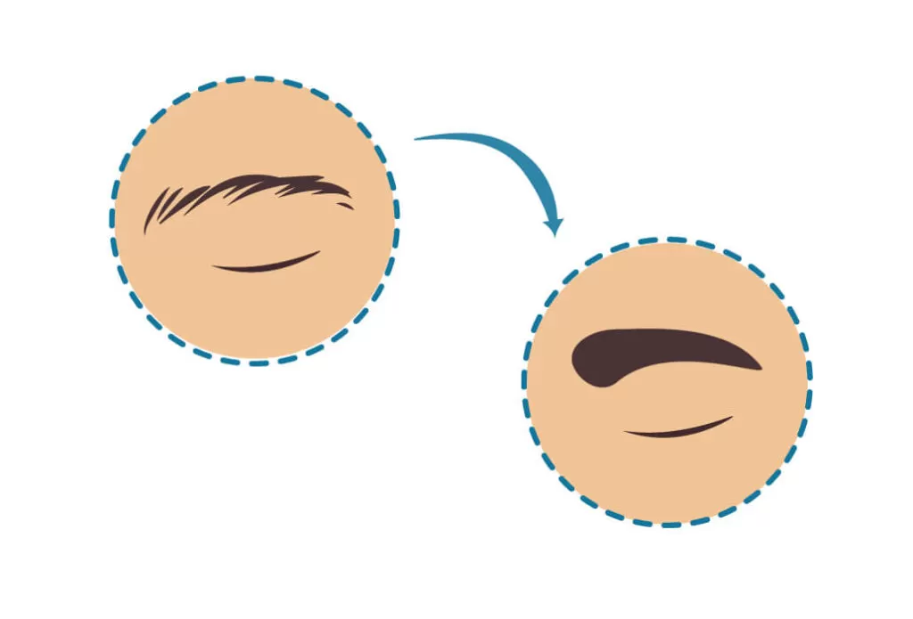 The Complete Guide to Eyebrow Transplant in the UK, Unveiling Beauty