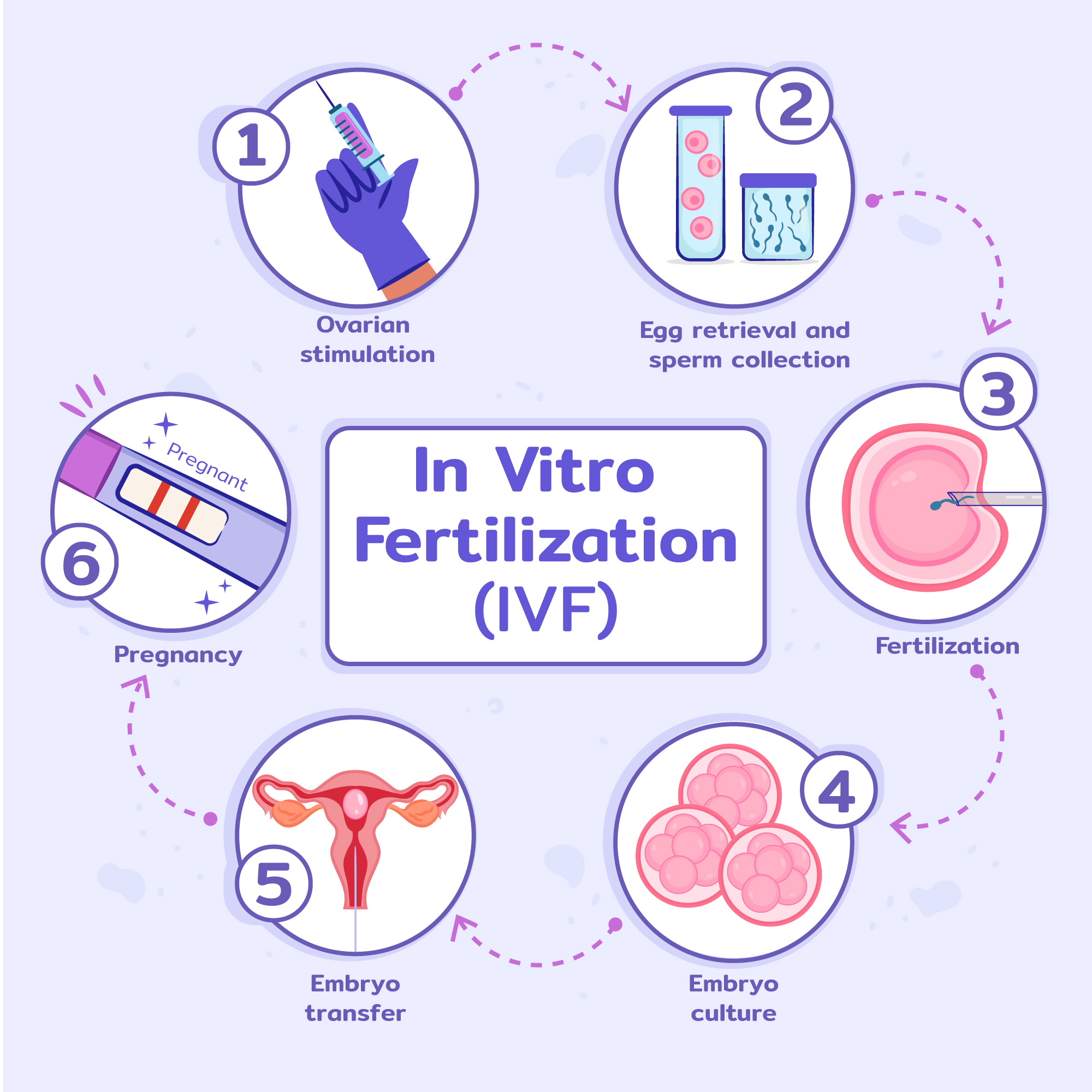 IVF is a Viable Option for Pakistani Couples