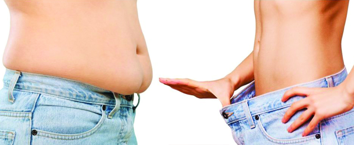 Getting More for Less: Liposuction Cost-Saving Measures in Dubai