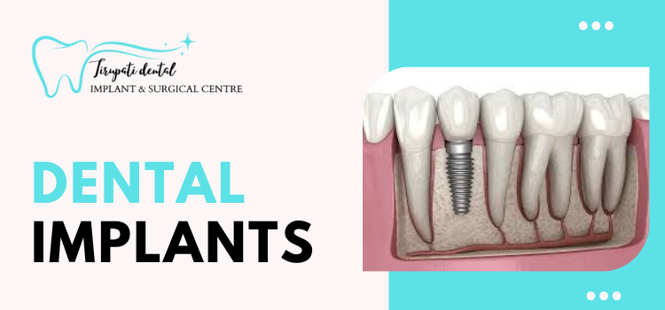 The Advantages of Dental Implants | TheAmberPost