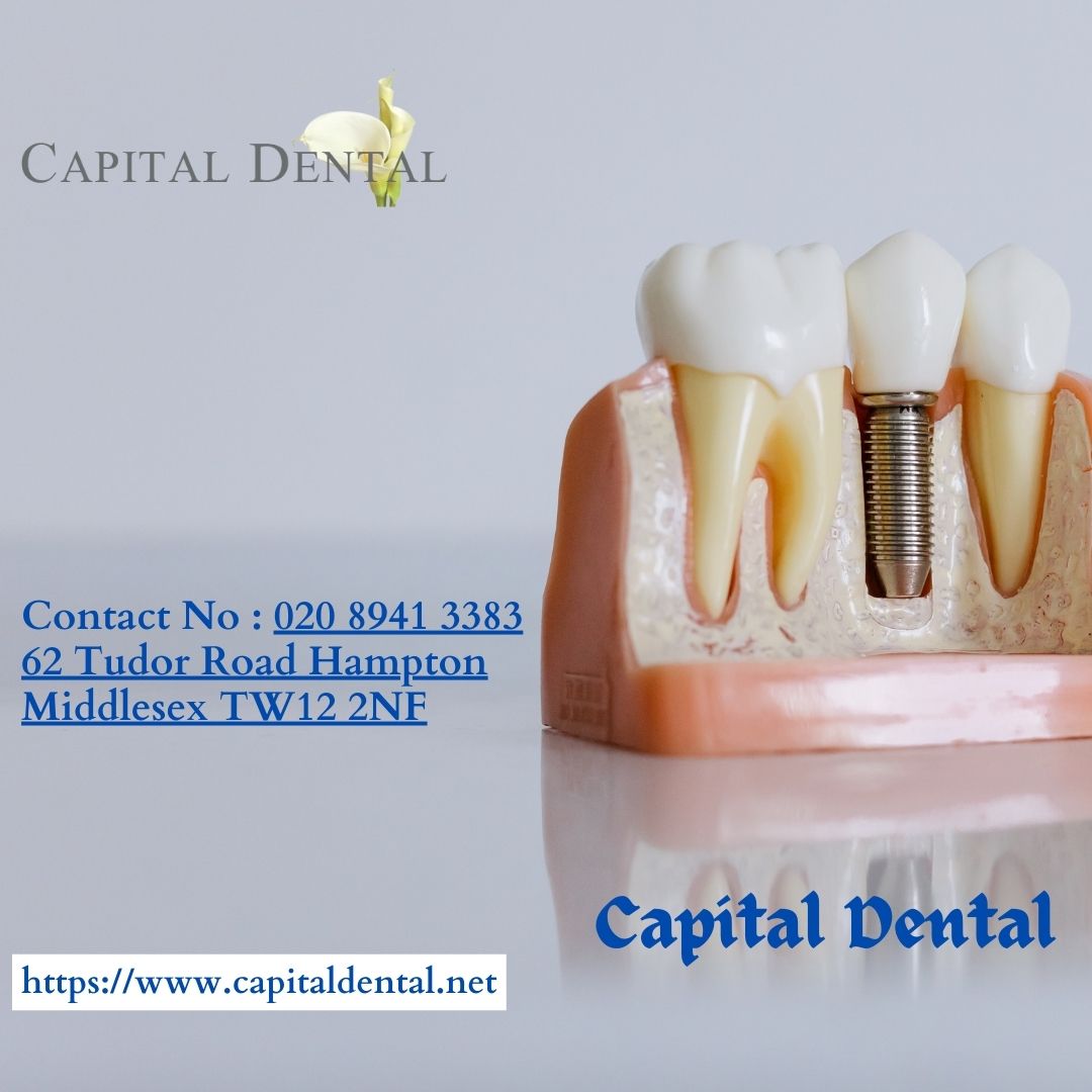 Capital Dental